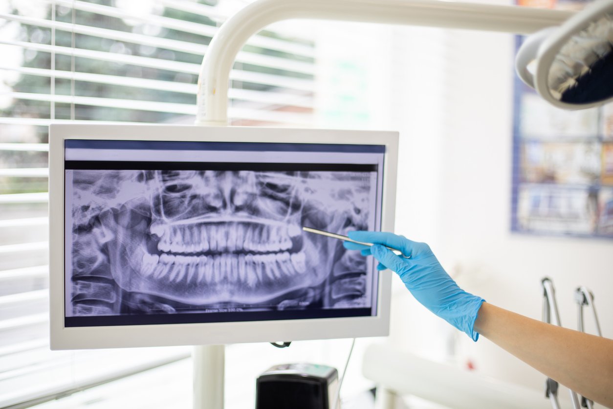 Dentist Bedford TX